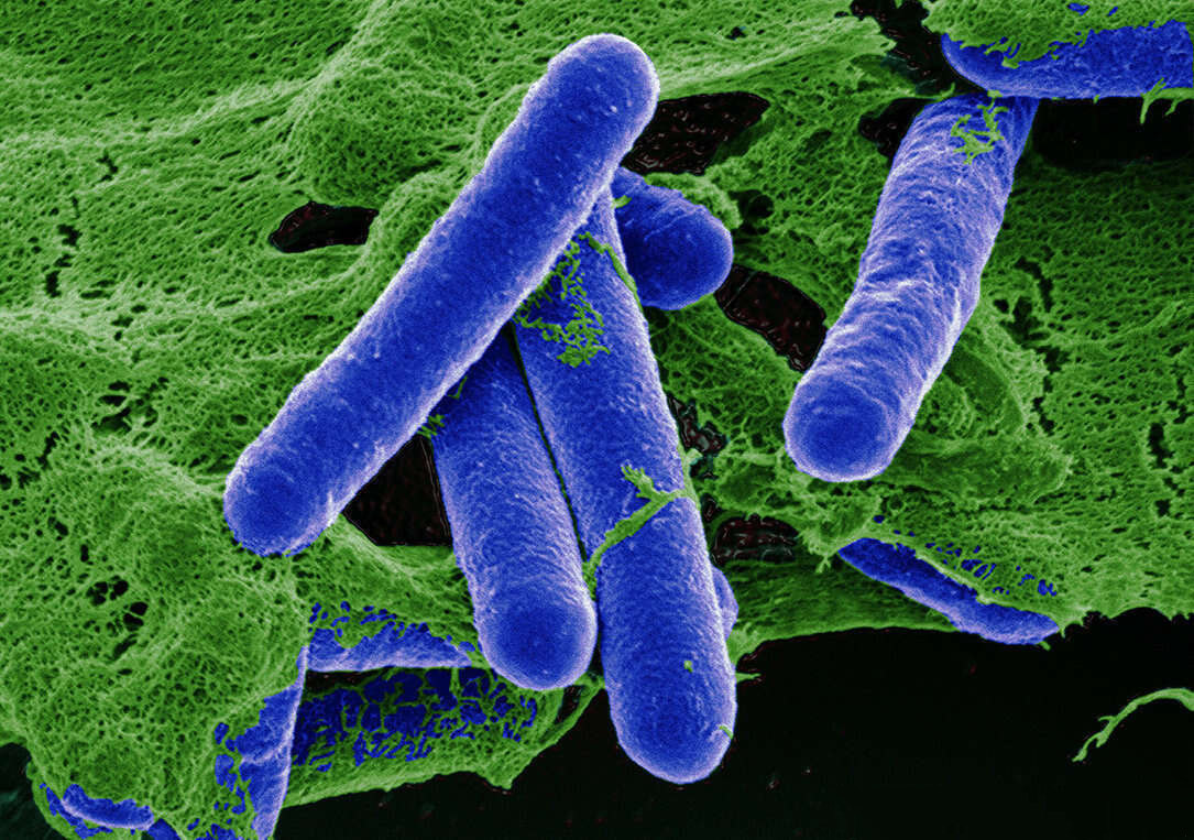 Clostridium Botulinum